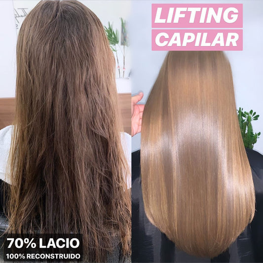 Lifting Capilar