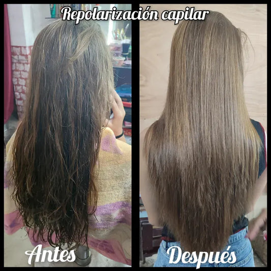 Repolarizacion